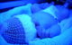 A baby sits under blue light in a phototherapy machine. (Photo by Jim Champion via Flickr/Creative Commons https://flic.kr/p/63WsH9)